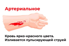 Артериально.png