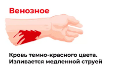 Венозное.png
